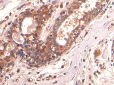 Monoclonal Antibody to Beta Catenin (β-catenin)