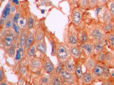 Monoclonal Antibody to Beta Catenin (β-catenin)