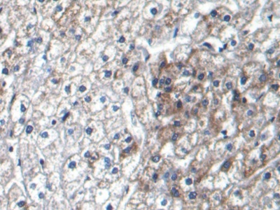 Monoclonal Antibody to Beta Catenin (β-catenin)