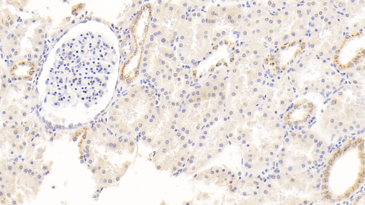 Monoclonal Antibody to Albumin (ALB)