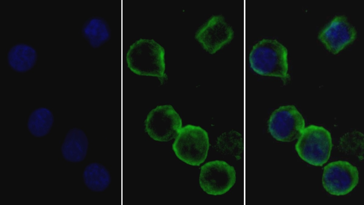 Monoclonal Antibody to Protein Tyrosine Phosphatase Receptor Type C (CD45)