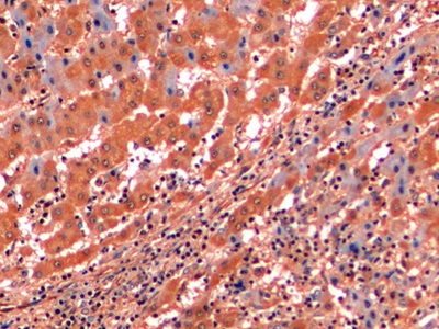 Monoclonal Antibody to Vimentin (VIM)