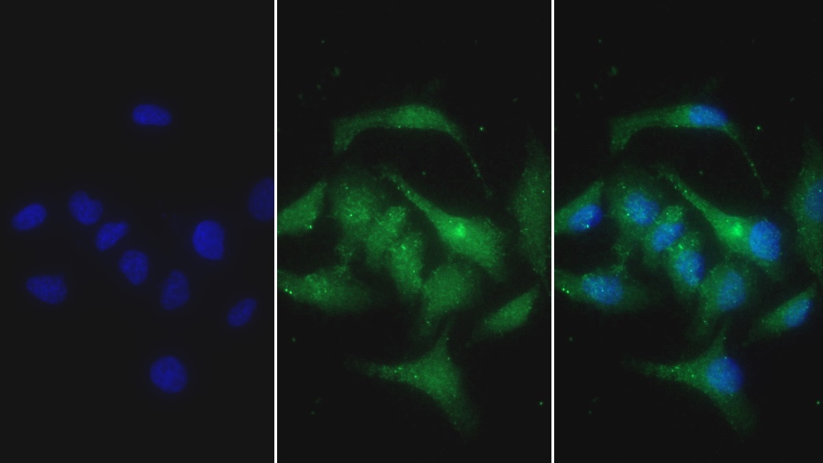 Monoclonal Antibody to S100 Calcium Binding Protein A12 (S100A12)