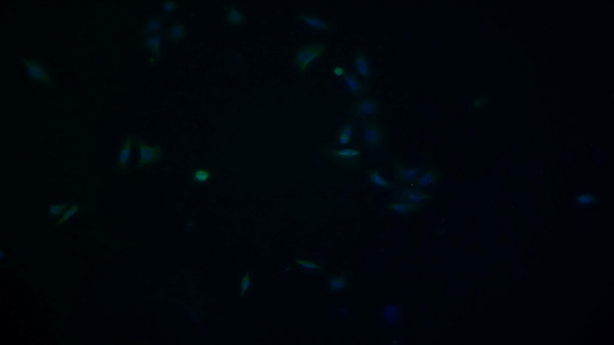 Monoclonal Antibody to Heat Shock 70kDa Protein 1A (HSPA1A)