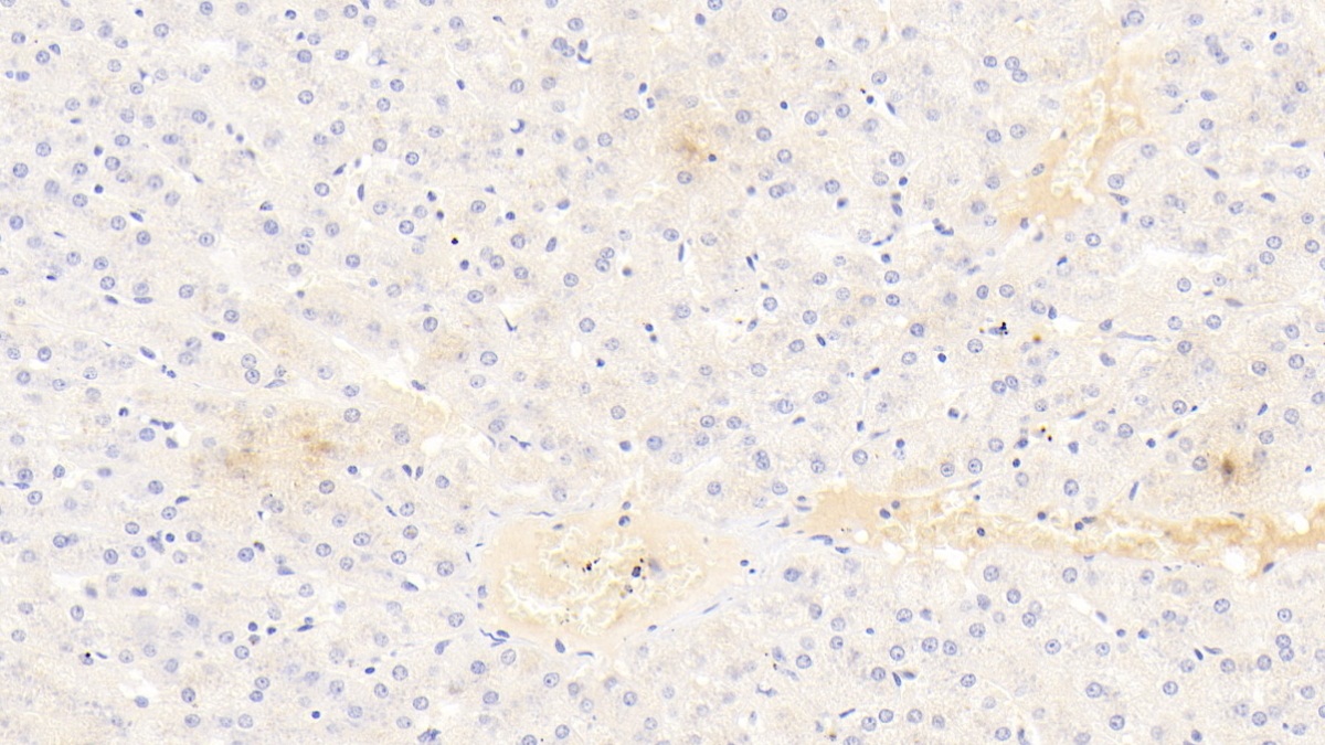 Monoclonal Antibody to Alkaline Phosphatase, Tissue-nonspecific (ALPL)