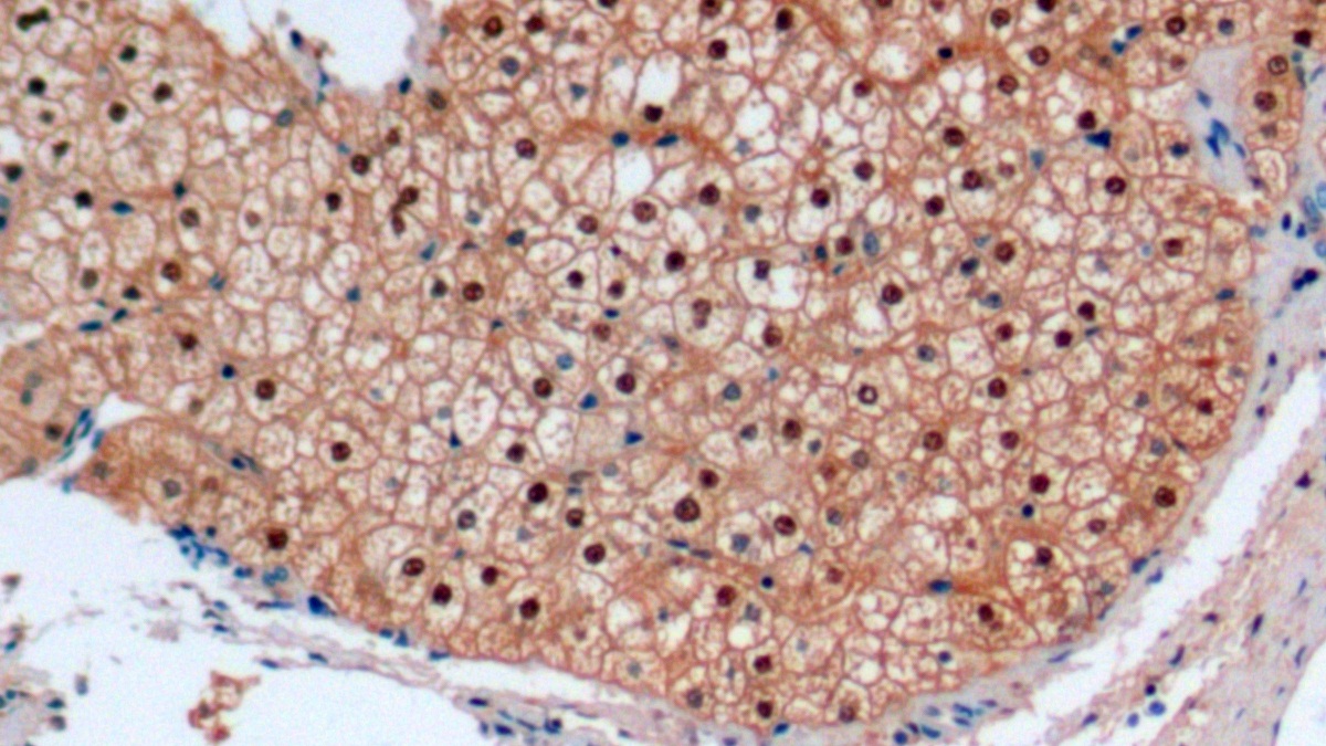 Monoclonal Antibody to Arginase (ARG)