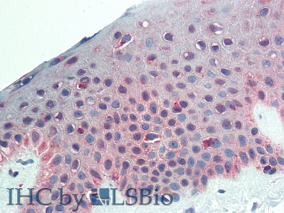 Monoclonal Antibody to Chondroitin Sulfate Proteoglycan 4 (CSPG4)