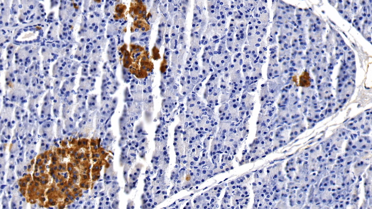 Monoclonal Antibody to Clusterin (CLU)