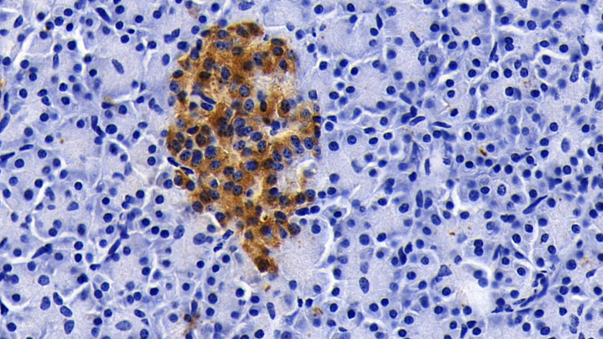 Monoclonal Antibody to Clusterin (CLU)