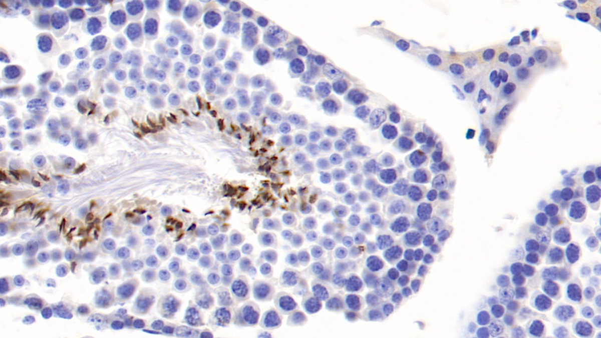 Monoclonal Antibody to Cartilage Oligomeric Matrix Protein (COMP)