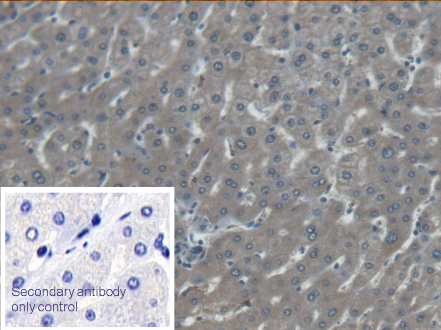 Monoclonal Antibody to Aspartate Aminotransferase (AST)