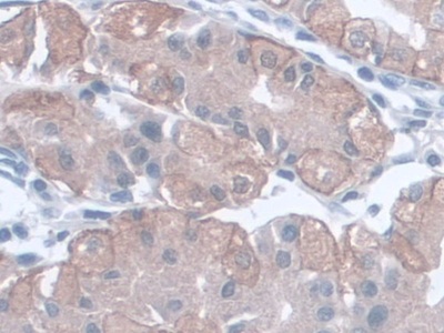 Monoclonal Antibody to Aspartate Aminotransferase (AST)