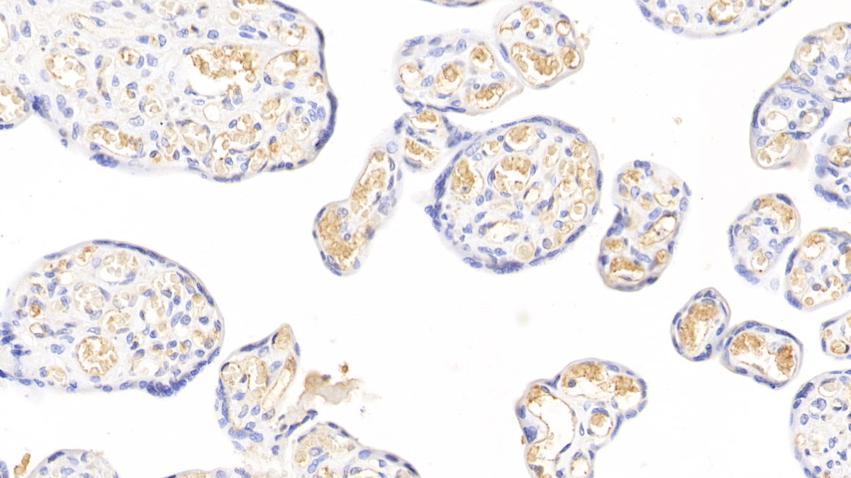 Monoclonal Antibody to Fibrinogen Beta Chain (FGB)