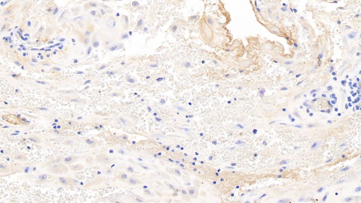 Monoclonal Antibody to Fibrinogen Beta Chain (FGB)