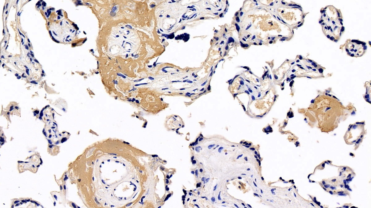 Monoclonal Antibody to Fibrinogen Beta Chain (FGB)