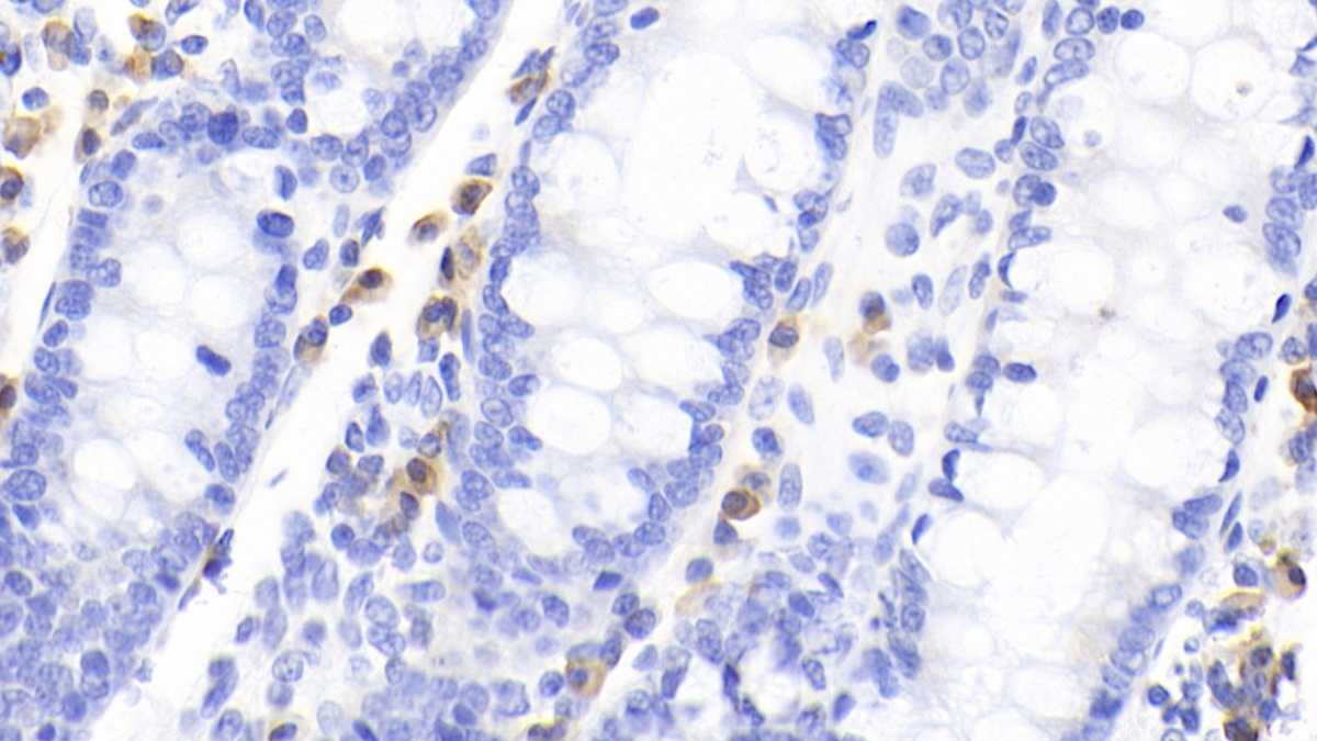 Monoclonal Antibody to Cytotoxic T-Lymphocyte Associated Antigen 4 (CTLA4)