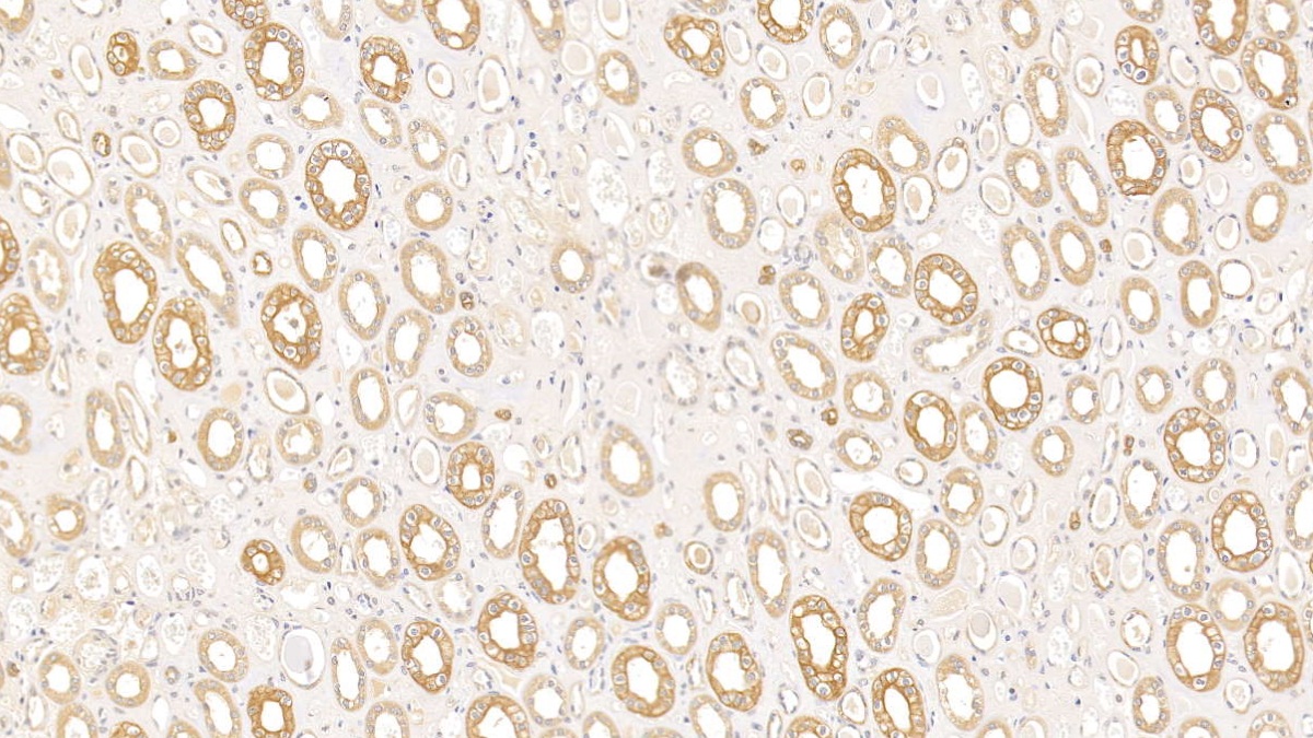 Monoclonal Antibody to Cytokeratin 18 (CK18)