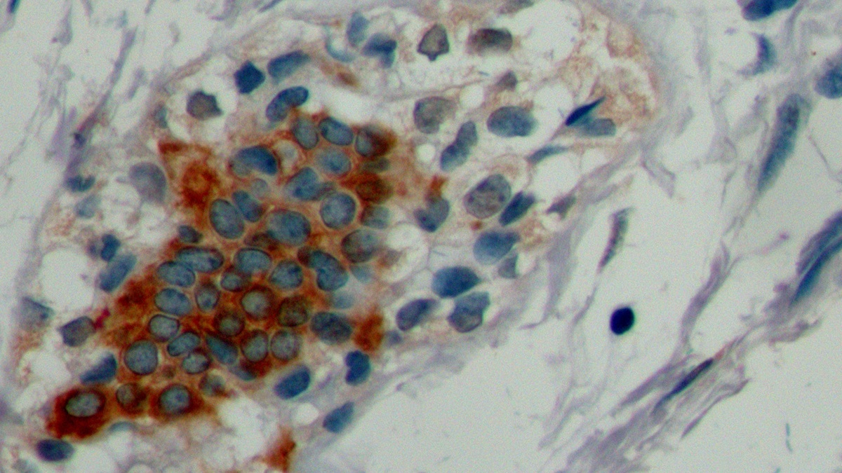 Monoclonal Antibody to Cytokeratin 19 (CK19)