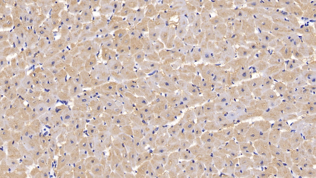 Monoclonal Antibody to Heart-type Fatty Acid Binding Protein (H-FABP)