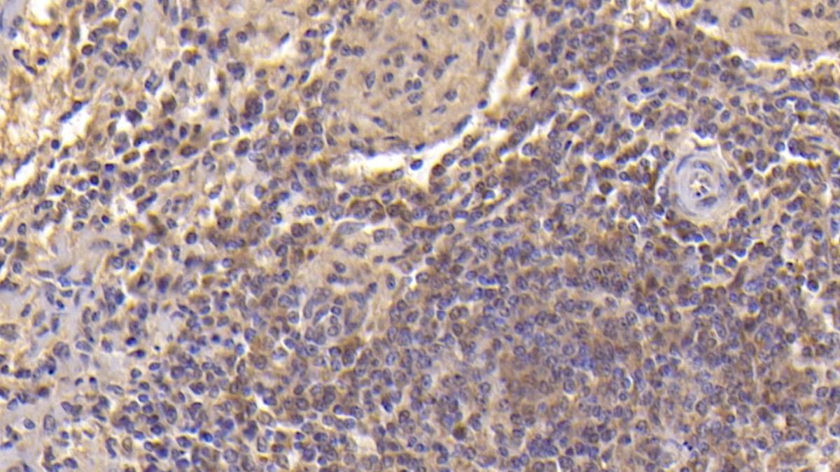 Monoclonal Antibody to Heart-type Fatty Acid Binding Protein (H-FABP)