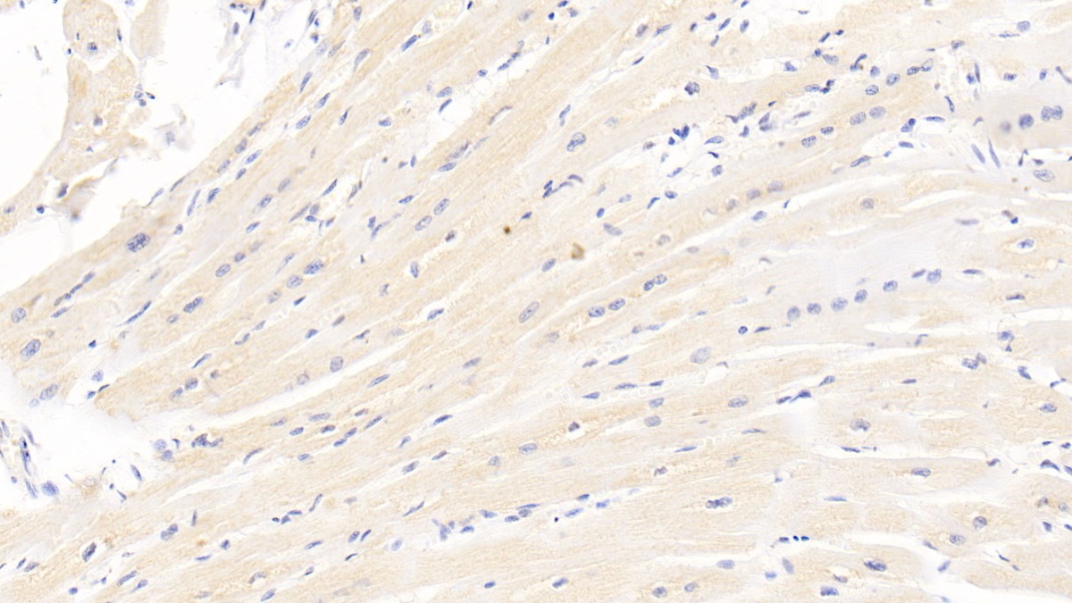 Monoclonal Antibody to Heart-type Fatty Acid Binding Protein (H-FABP)