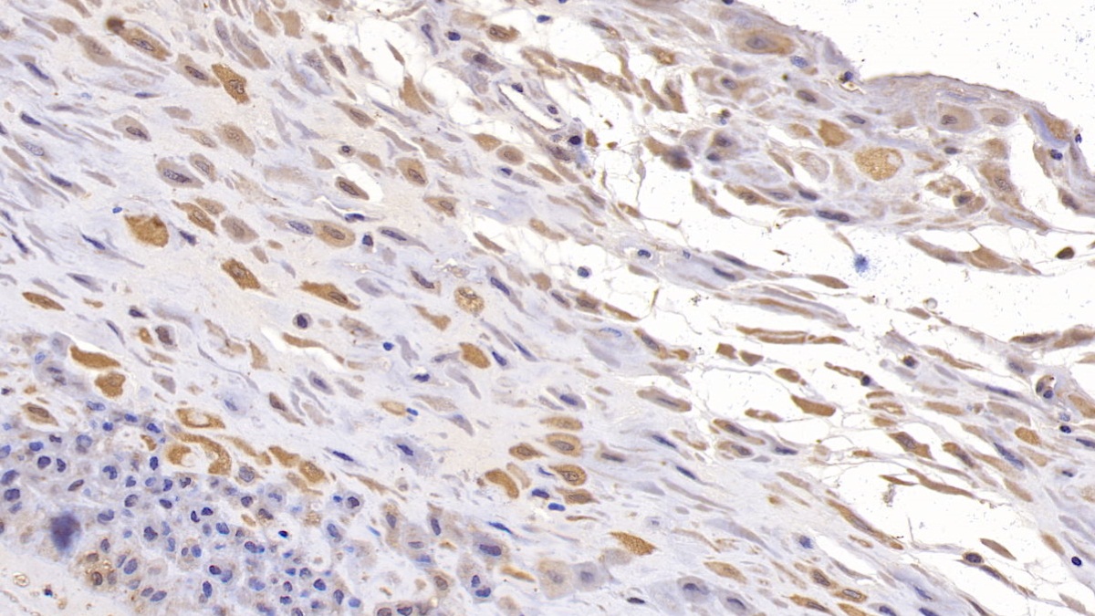 Monoclonal Antibody to Cluster Of Differentiation 73 (CD73)