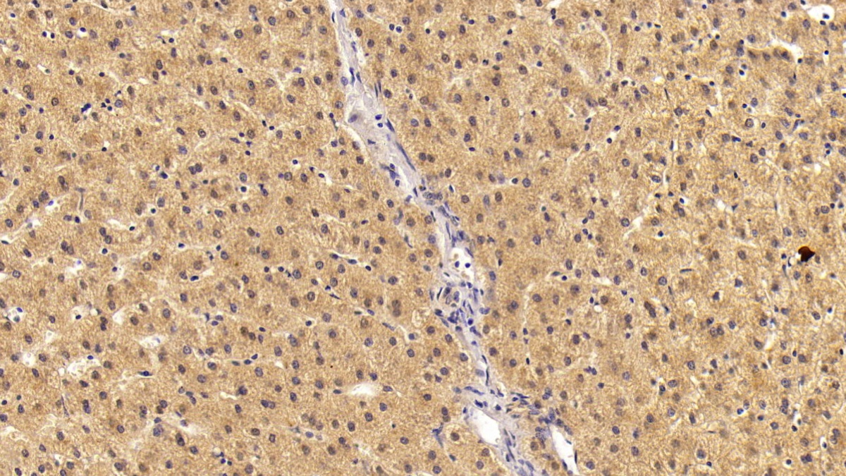 Monoclonal Antibody to Angiostatin (ANG)