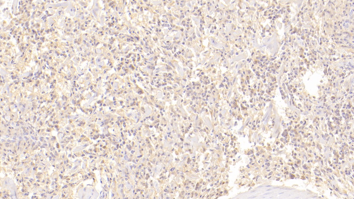 Monoclonal Antibody to Cluster Of Differentiation 72 (CD72)