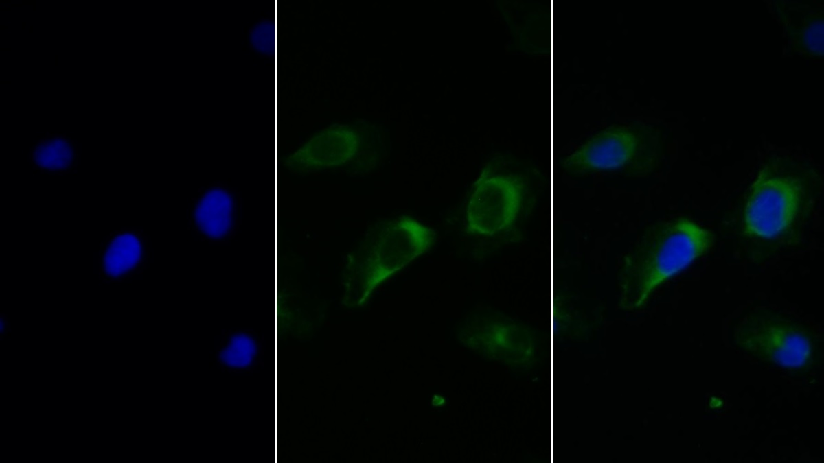 Monoclonal Antibody to Fc Fragment Of IgG Low Affinity IIIb Receptor (FcgR3B)