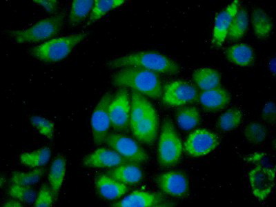 Monoclonal Antibody to Cathepsin D (CTSD)