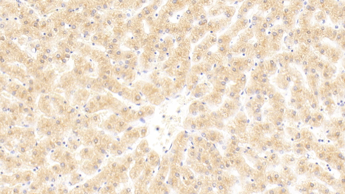 Monoclonal Antibody to Complement C4-B (C4B)