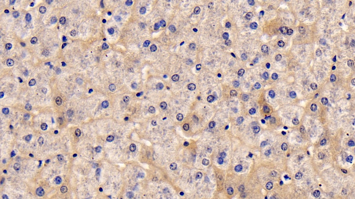 Monoclonal Antibody to Thymic Stromal Lymphopoietin (TSLP)