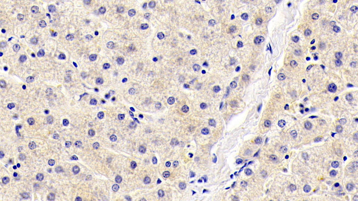 Monoclonal Antibody to Thymic Stromal Lymphopoietin (TSLP)