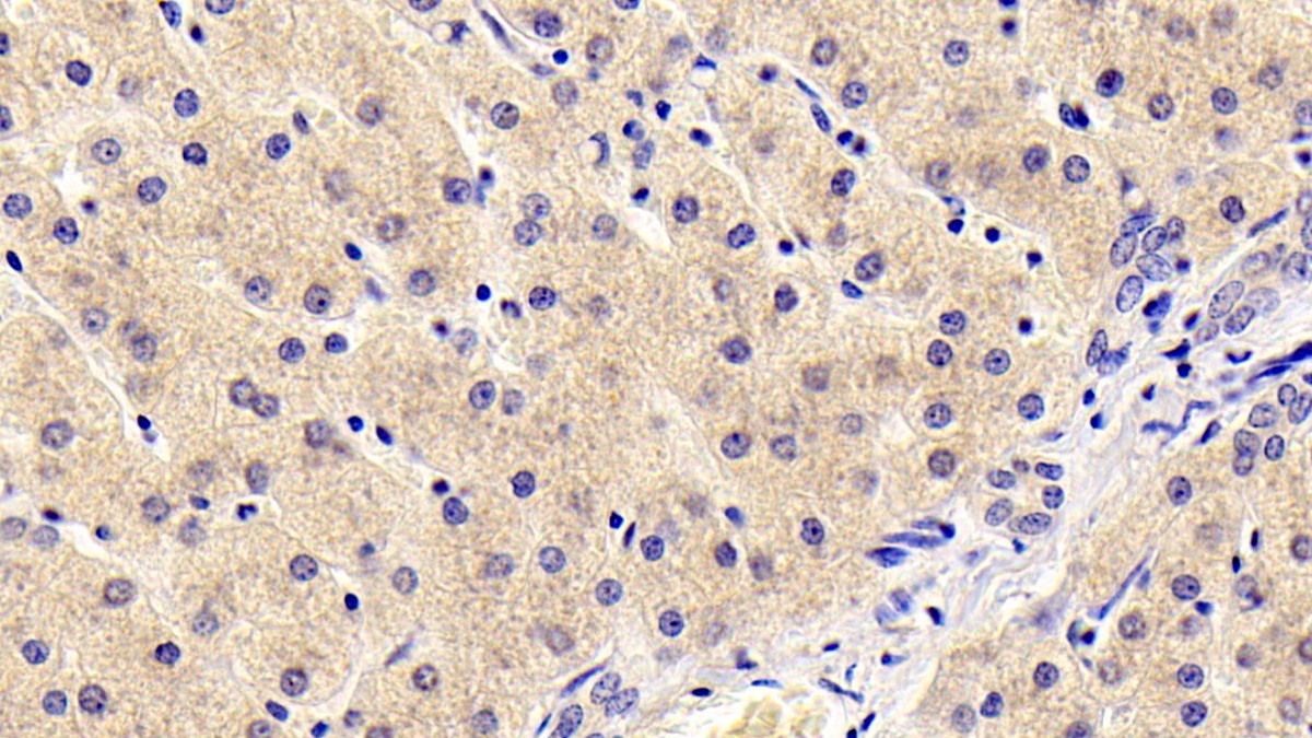 Monoclonal Antibody to Thymic Stromal Lymphopoietin (TSLP)