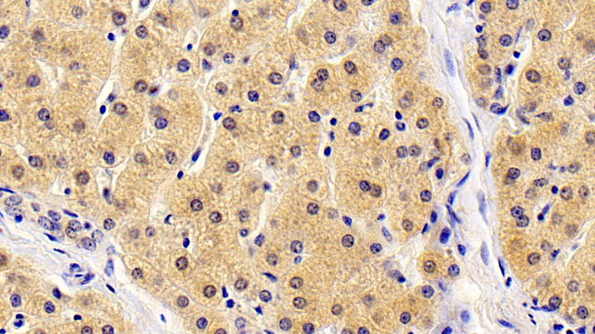 Monoclonal Antibody to Thymic Stromal Lymphopoietin (TSLP)