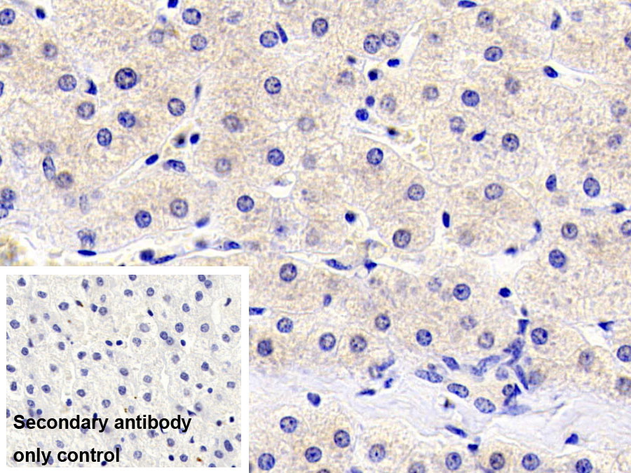 Monoclonal Antibody to Thymic Stromal Lymphopoietin (TSLP)