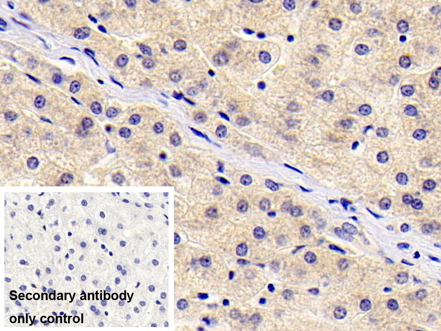 Monoclonal Antibody to Thymic Stromal Lymphopoietin (TSLP)