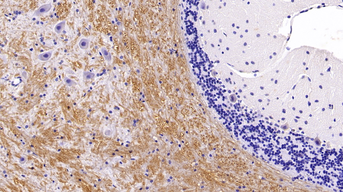 Monoclonal Antibody to Microtubule Associated Protein 2 (MAP2)