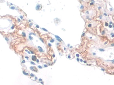 Monoclonal Antibody to Elastin (ELN)