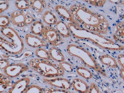 Monoclonal Antibody to Beta Actin (ACTB)