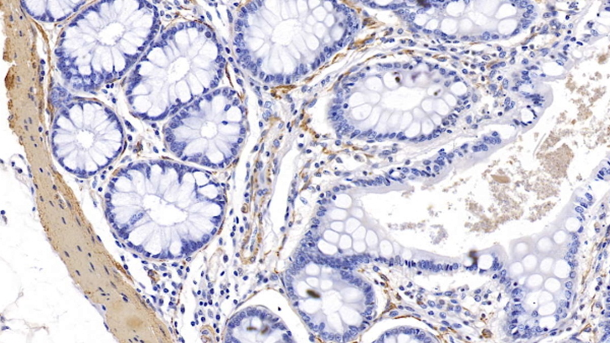 Monoclonal Antibody to Actin Alpha 1, Cardiac Muscle (ACTC1)