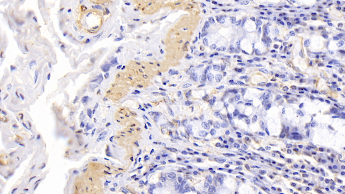 Monoclonal Antibody to Actin Alpha 1, Cardiac Muscle (ACTC1)