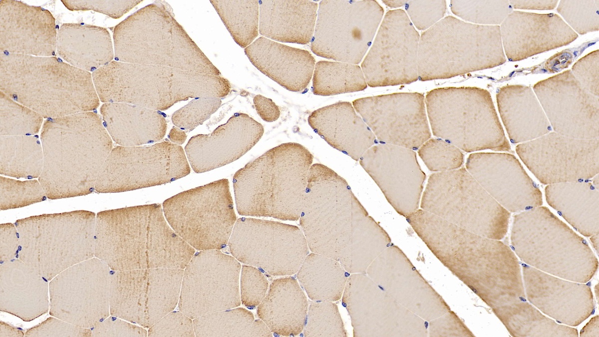 Monoclonal Antibody to Actin Alpha 1, Cardiac Muscle (ACTC1)