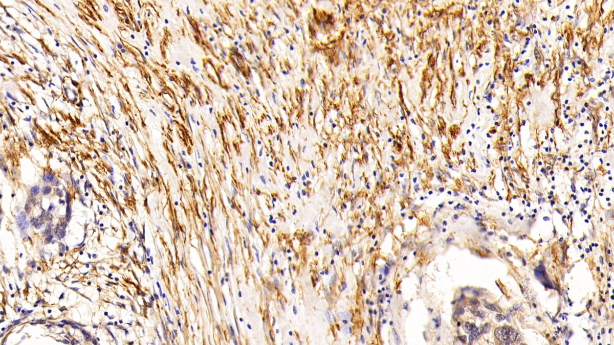 Monoclonal Antibody to Actin Alpha 2, Smooth Muscle (ACTa2)