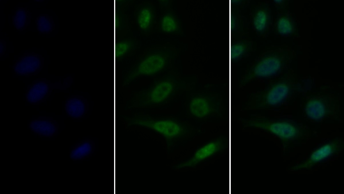 Monoclonal Antibody to Vascular Endothelial Growth Factor Receptor 2 (VEGFR2)