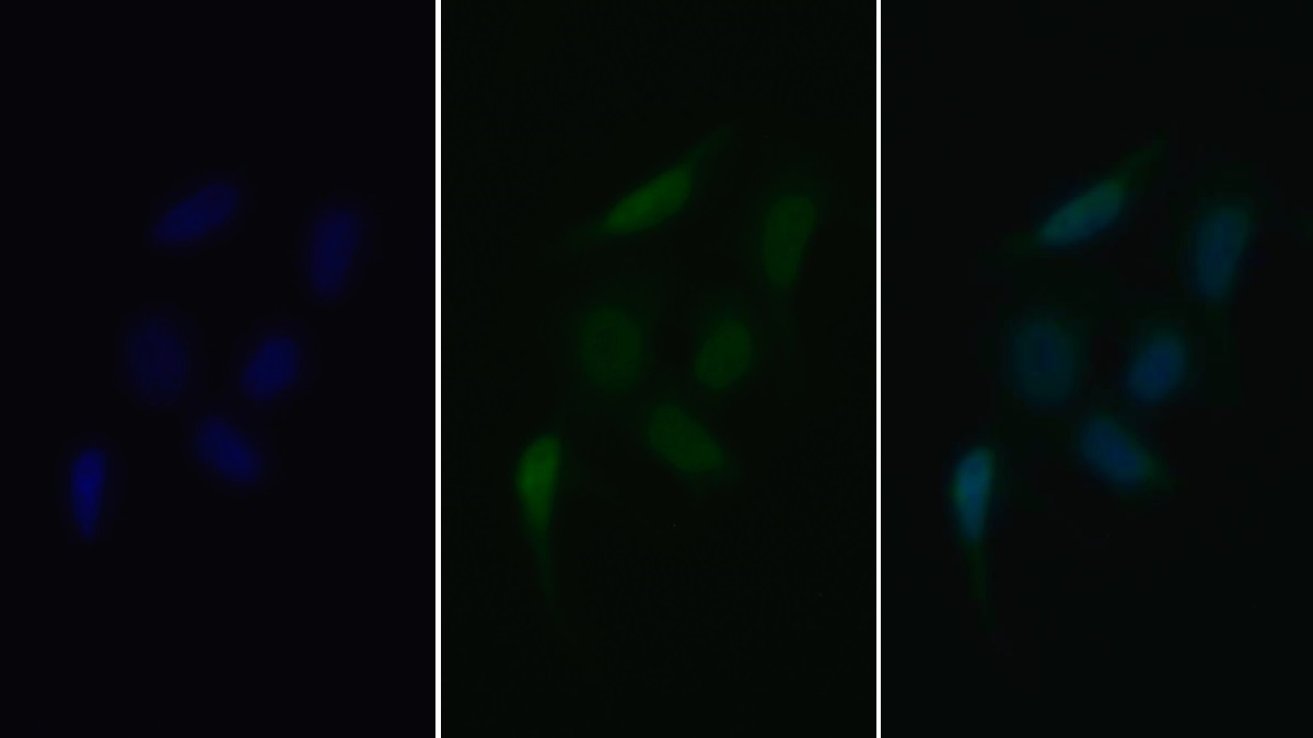 Monoclonal Antibody to Vascular Endothelial Growth Factor Receptor 2 (VEGFR2)