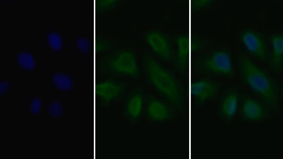 Monoclonal Antibody to Vascular Endothelial Growth Factor Receptor 2 (VEGFR2)