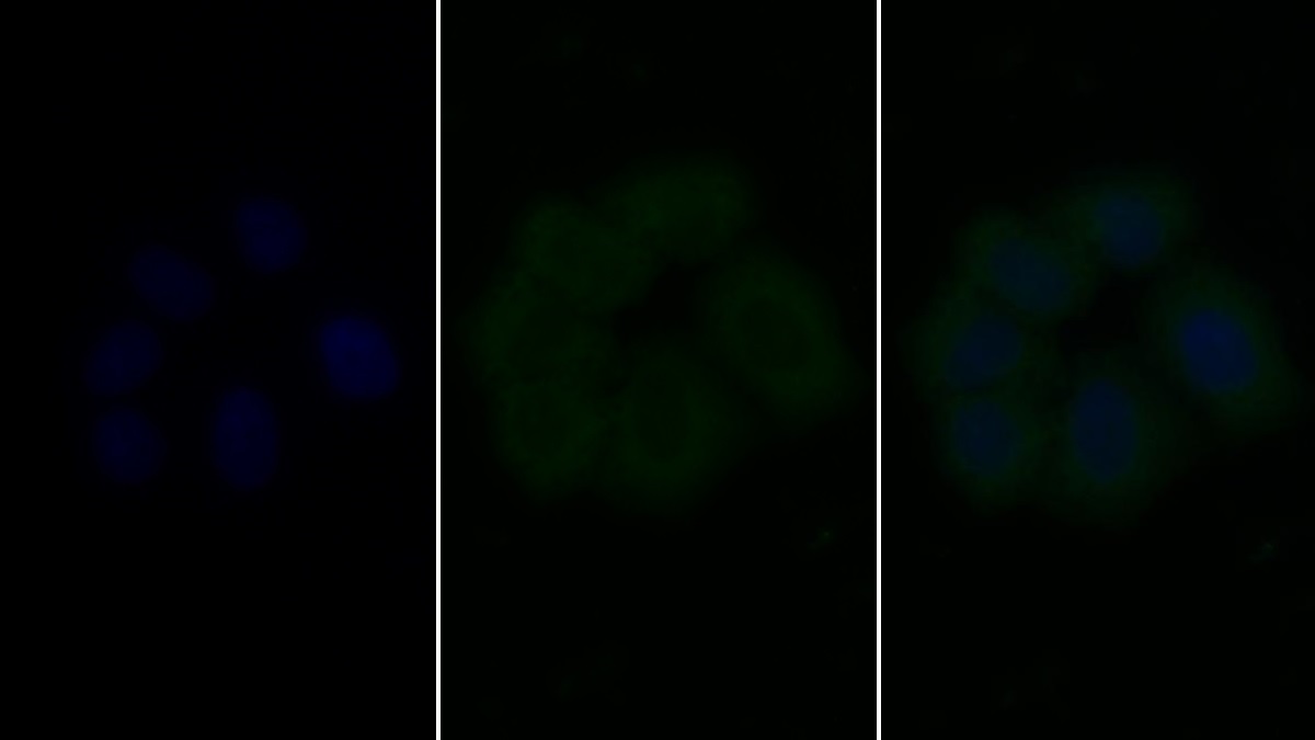 Monoclonal Antibody to Vascular Endothelial Growth Factor Receptor 2 (VEGFR2)