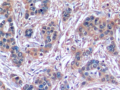 Monoclonal Antibody to Serpin B3 (SERPINB3)