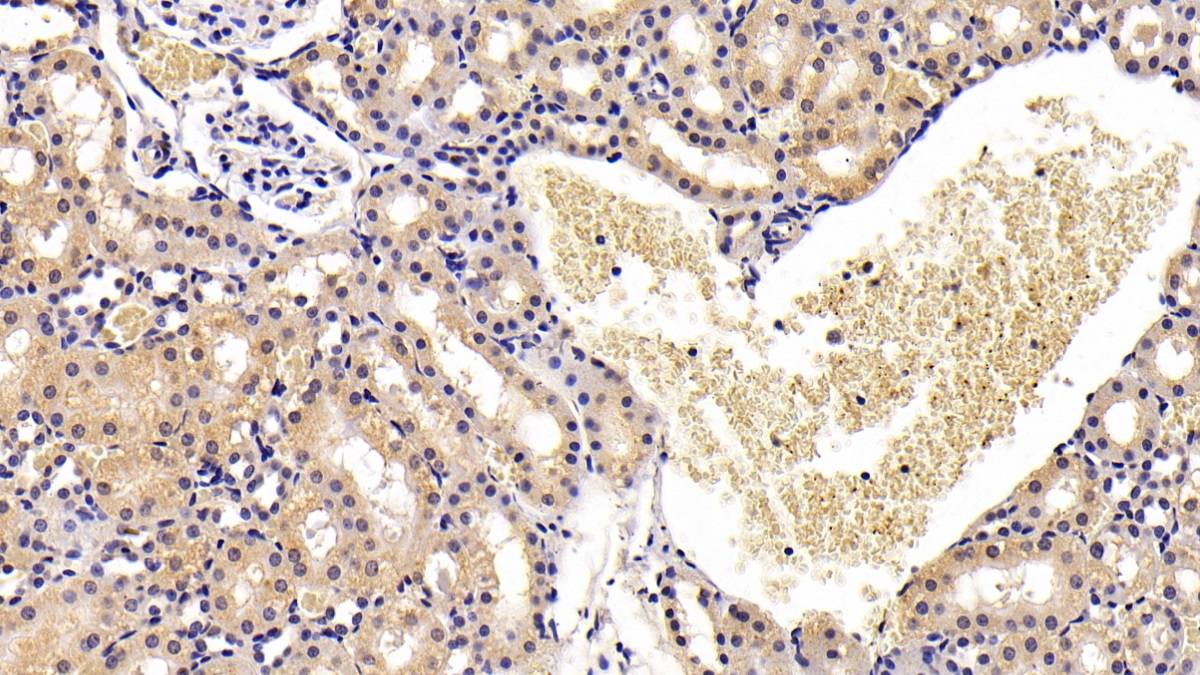 Monoclonal Antibody to Defensin Beta 1 (DEFb1)